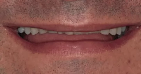 Os Dentes Contribuem para o Envelhecimento da Face?