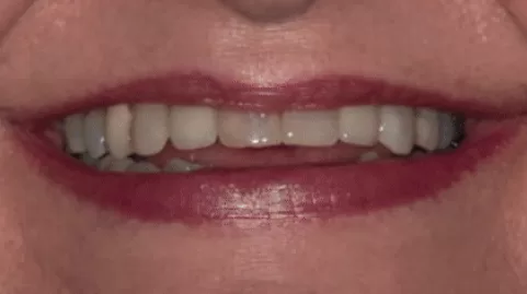 Os Dentes Contribuem para o Envelhecimento da Face?