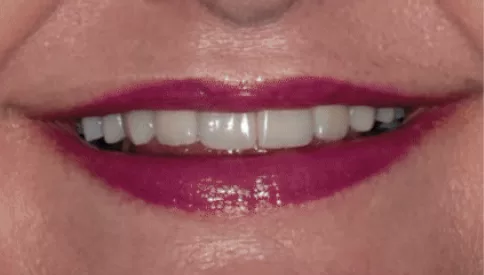 Os Dentes Contribuem para o Envelhecimento da Face?